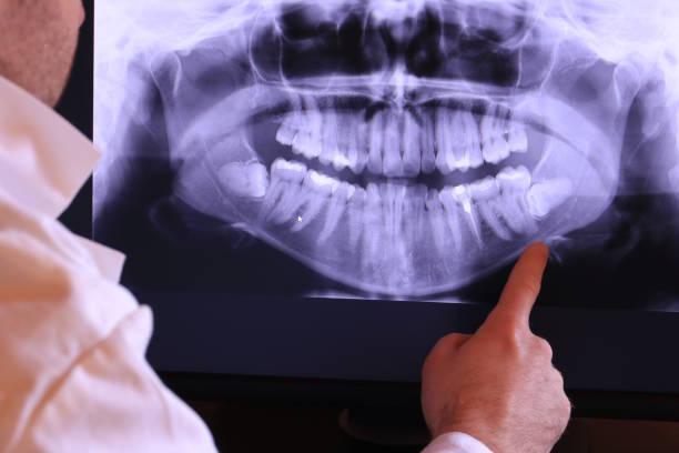 Best Walk-In Dentist Near Me  in Bude, MS